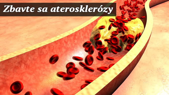 Nepriateľ menom cholesterol